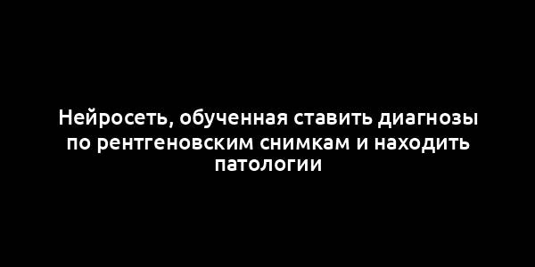 Нейросеть, обученная ставить диагнозы по рентгеновским снимкам и находить патологии