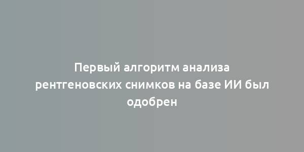 Первый алгоритм анализа рентгеновских снимков на базе ИИ был одобрен